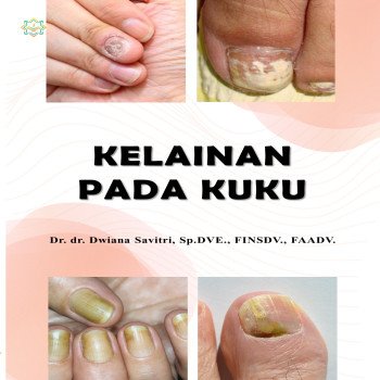 KELAINAN PADA KUKU